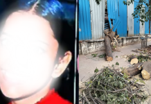मुंबईत खारचे झाड कोसळले: एका आठवड्यानंतर ब्रेन-डेड तरुणाचे निधन; बिल्डरवर निर्दोष हत्येचा गुन्हा दाखल